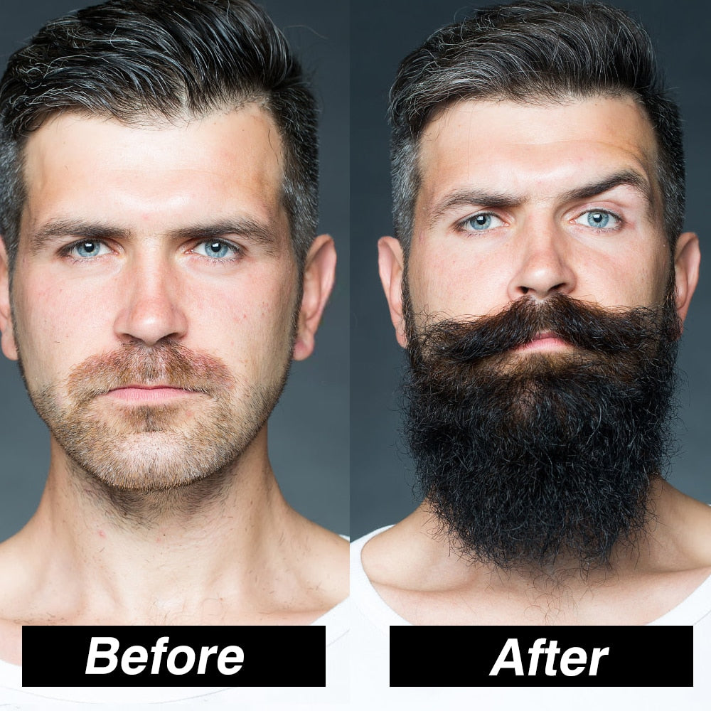 Men's Beard Growth Kit